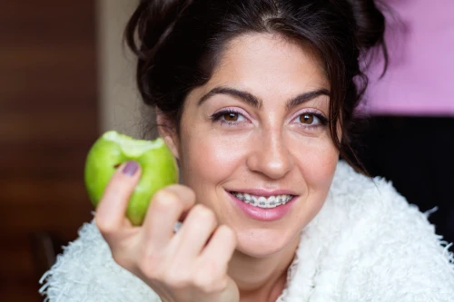 Read more about the article Braces for Adults: Why It’s Never Too Late